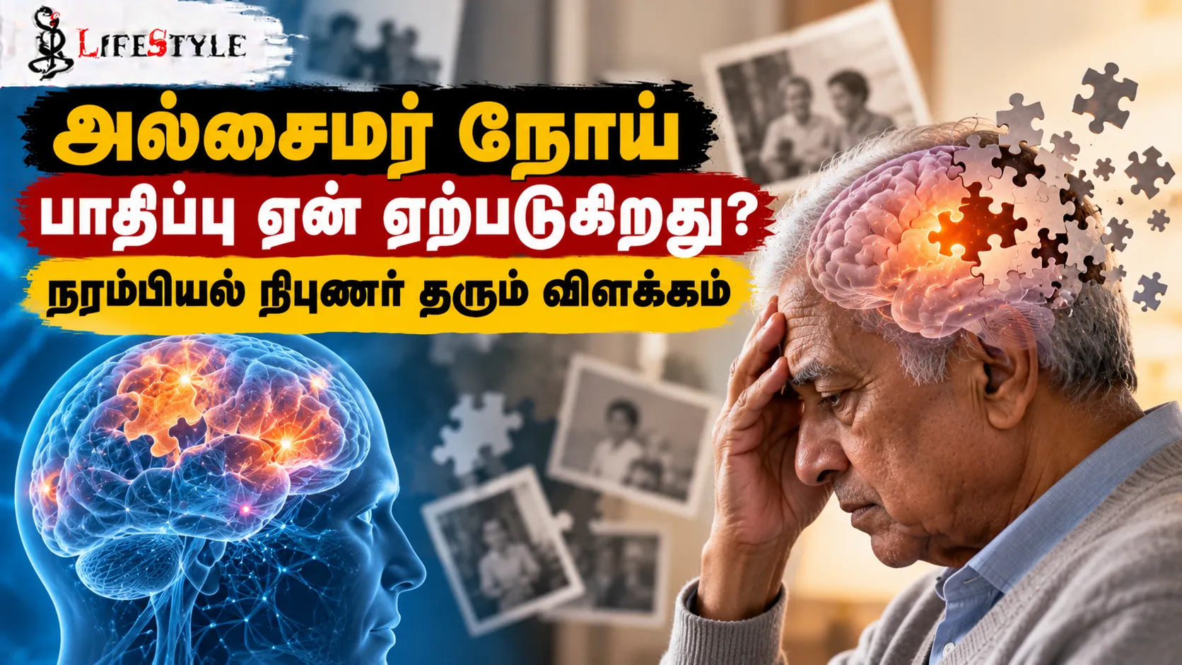 அல்சைமர் நோய் பாதிப்பு ஏன் ஏற்படுகிறது? நரம்பியல் நிபுணர் தரும் விளக்கம்